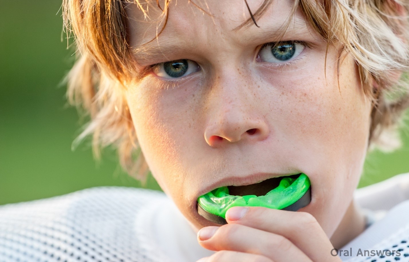 How will someone benefit from wearing a mouth guard?